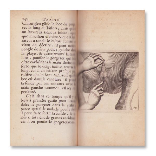 François Tolet, Tratat despre litotomie sau extragerea calculilor din vezică urinară, 1686, oferit dr. urolog Theodor Burghele 