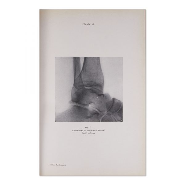 Prof. Pierre Duval, La réduction des fractures sous l'écran radioscopique, 1928, cu dedicație 