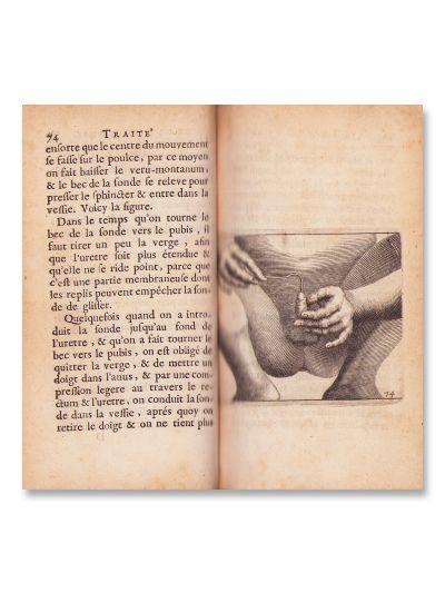 François Tolet, Tratat despre litotomie sau extragerea calculilor din vezică urinară, 1686, din biblioteca dr. urolog Theodor Burghele 